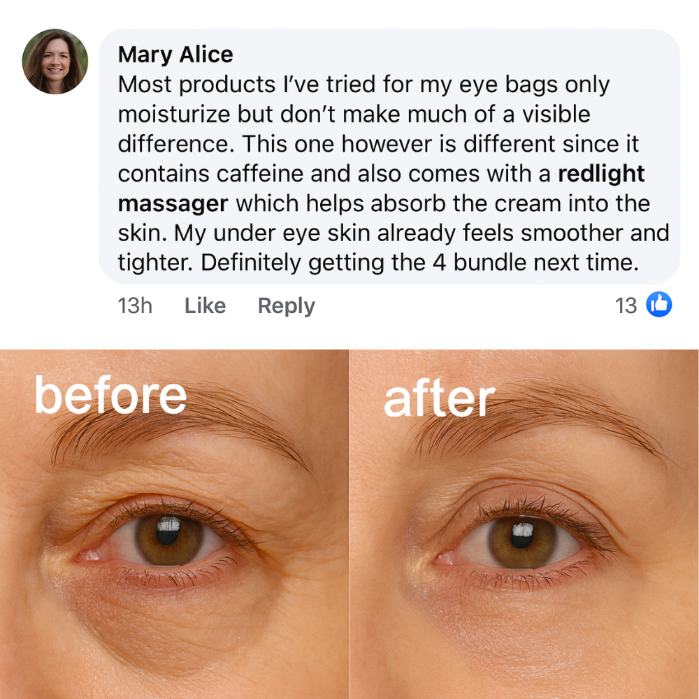 EYEUNDER™ Dark Circles & Bag Eye Cream